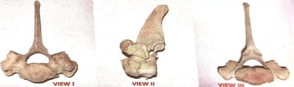Vertebrae